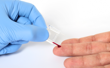 complete blood count capillary sampling