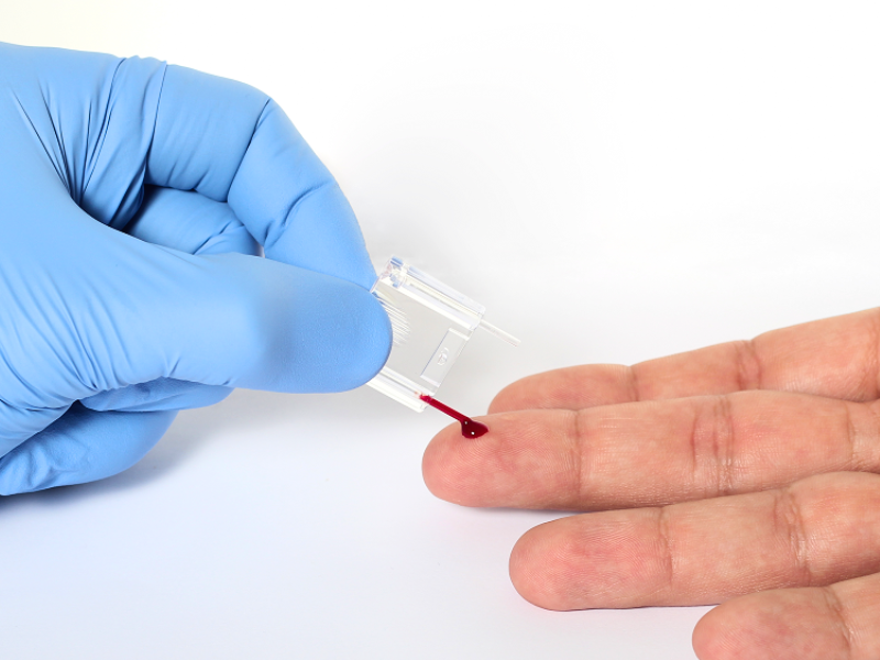 complete blood count capillary sampling