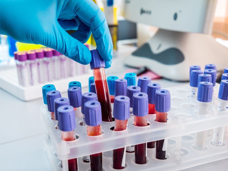 cost of cbc analyzers