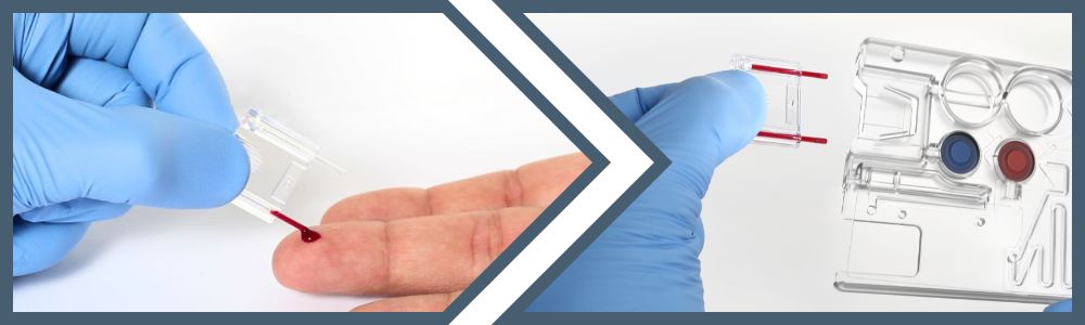 cbc direct capillary blood draw - pediatrics